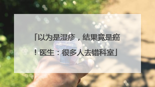 以为是湿疹，结果竟是癌！医生：很多人去错科室
